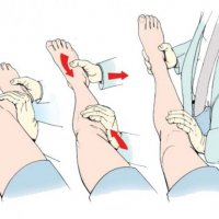 Вправление вывиха, закрытая ручная репозиция (без стоимости медикаментов)