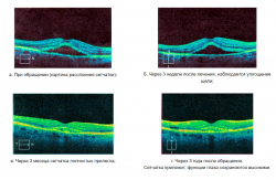 КОМПЛЕКСНЫЕ МЕТОДЫ ЛЕЧЕНИЯ