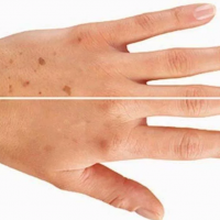 Руки полностью