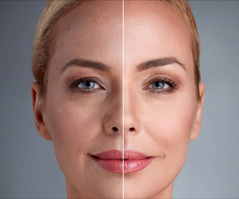 Бьютификация лица