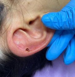 Прокол ушей