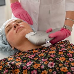 SMAS - лифтинг, глаза (переорбитальная зона)