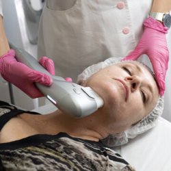 SMAS - лифтинг, глаза (переорбитальная зона)