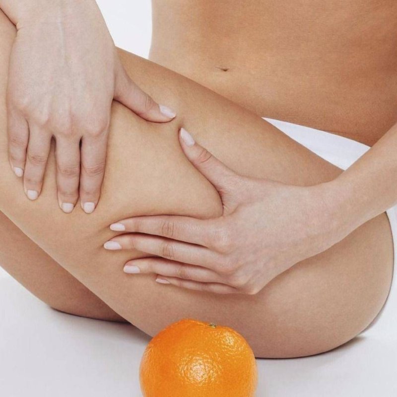 "Массаж антицеллюлитный (одна зона) (40 минут)"