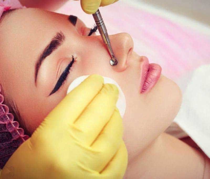 Механическая чистка лица