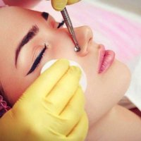 Механическая чистка лица