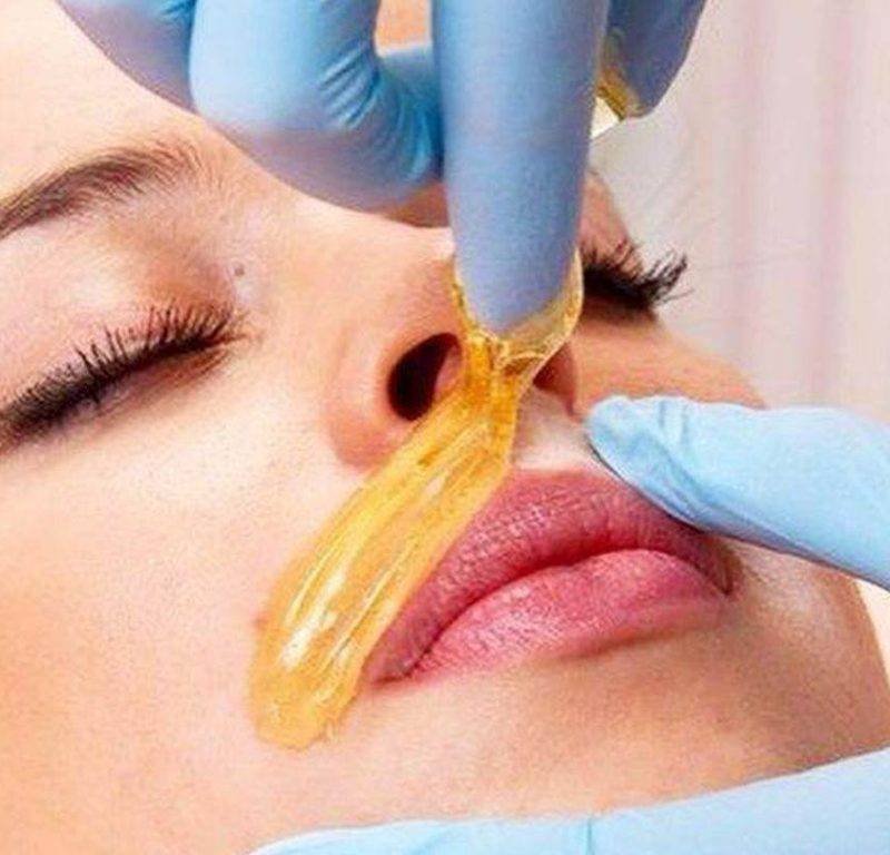 Депиляция одной зоны на лице воском