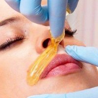 Депиляция одной зоны на лице воском