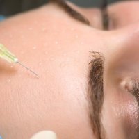 Биоревитализация «Коктейль Монако»