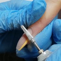 Снятие искусственного материала без последующего покрытия