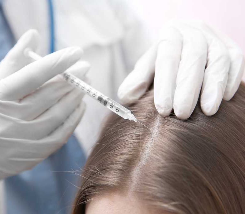 Мезотерапия для волос 