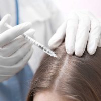 Мезотерапия для волос 