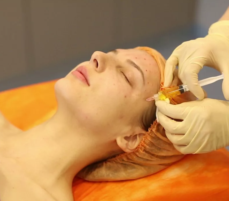 Плазмолифтинг лицо+шея