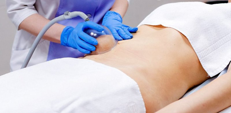 Старвак(талия,живот) 30 минут 