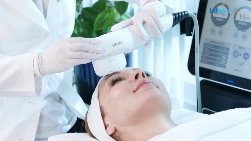 Малярный мешок, лифтинг брови, височная область, лифтинг орбиты