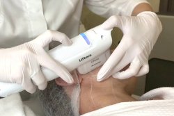 Нос. Компактизация хряща носа