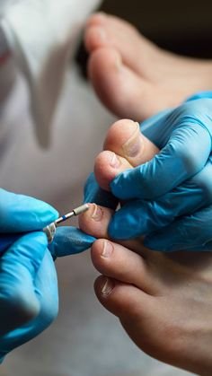 Частичный педикюр (либо пальцы,либо стопа)