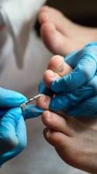 Частичный педикюр (либо пальцы,либо стопа)