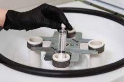 Внутрикожное введение плазмы крови 