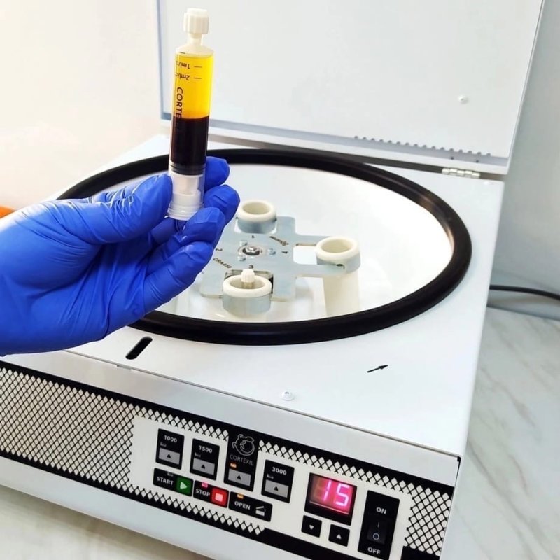 Внутрикожное введение плазмы крови 