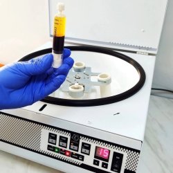 Внутрикожное введение плазмы крови 