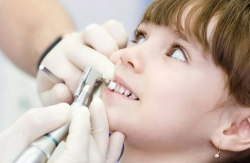 Профессиональная гигиена молочных зубов