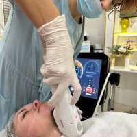 Ультразвуковое лечение кожи - Шея /3000 импульсов