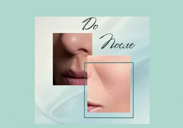 КАБИНЕТ ЭПИЛЯЦИИ